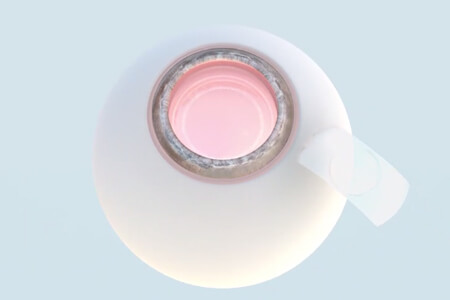 PRL手術(shù)是什么意思？