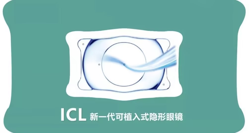 合肥ICL晶體植入近視手術(shù)，您了解多少？